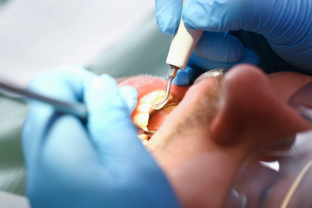 Best Emergency Treatment for Dental Infections or Abscesses in North Pekin, IL