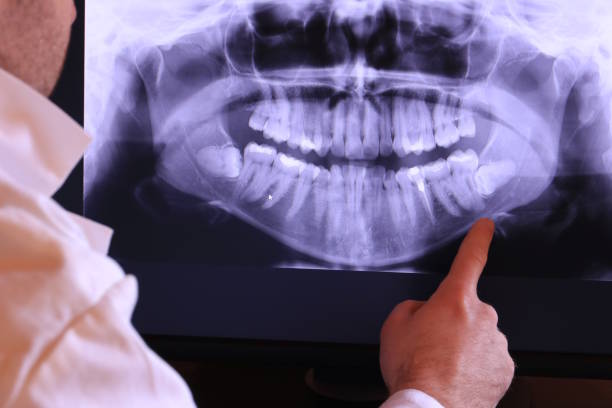 Best Cosmetic Emergency Dentistry in North Pekin, IL